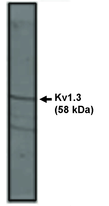 "
Western blot analysis
using Kv1.3 antibody on
rat brain lysate."